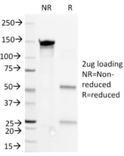 Mouse anti-CD36/SR-B3, Clone: 1E8., Novus Biologicals 0.2mg; Unlabeled:Antibodies,